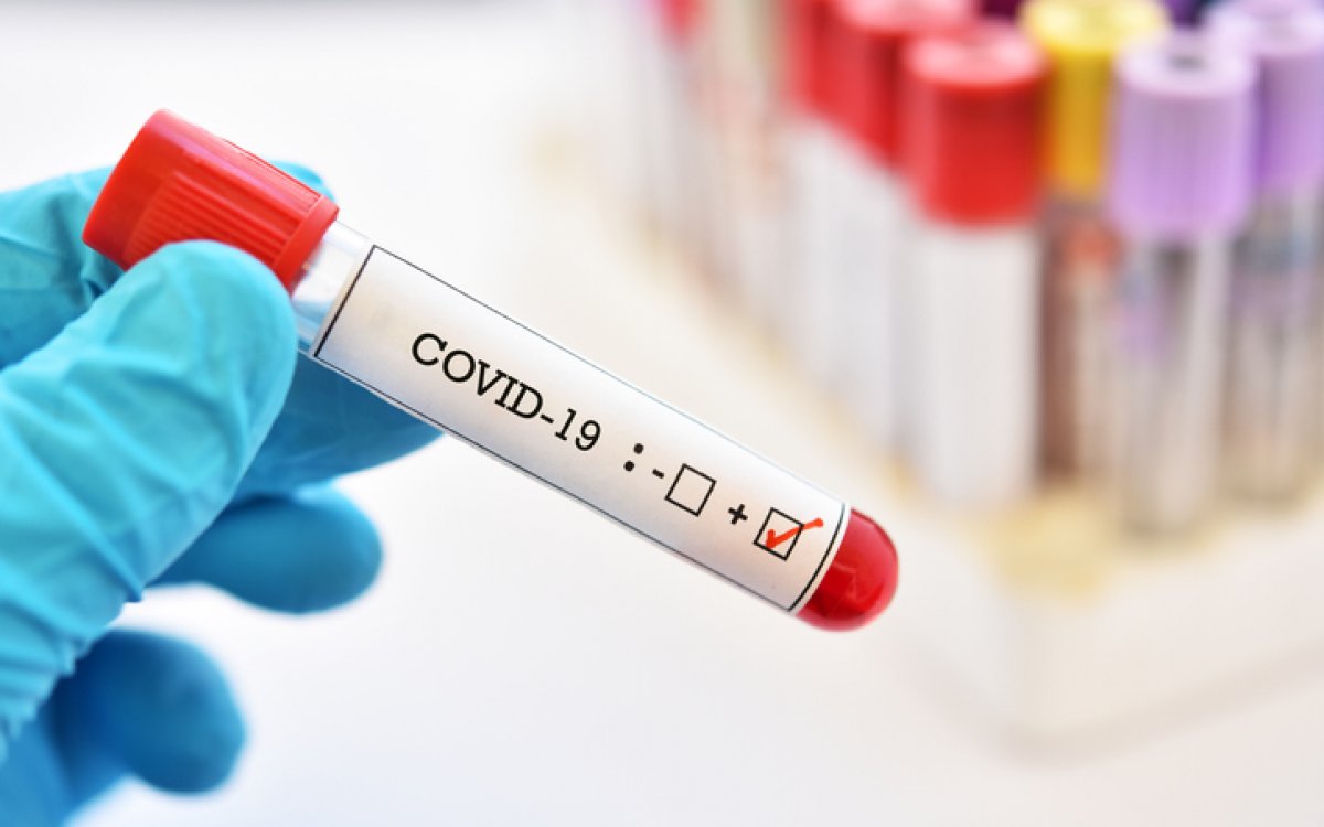 On puc fer el test del coronavirus?