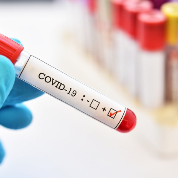 ¿Dónde puedo hacerme el test del coronavirus?