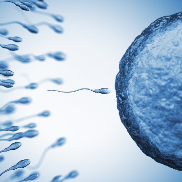 Fragmentación del ADN espermático e infertilidad masculina